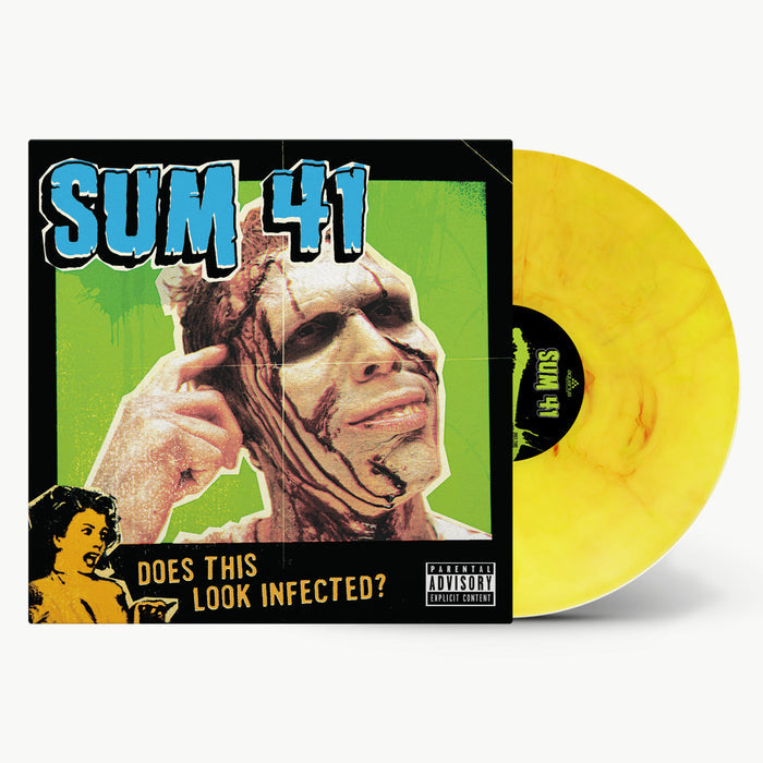 Sum 41 